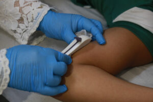 Saúde e autonomia para adolescentes: implante subdérmico é oferecido como método contraceptivo em hospitais e postos de saúde de Fortaleza