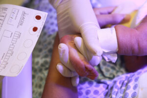 Teste do pezinho: exame ofertado gratuitamente nos postos de saúde de Fortaleza promove detecção precoce de diversas doenças