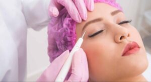 Jato de plasma: o que você precisa saber antes de apostar no procedimento estético