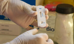 Dezembro Vermelho: Prefeitura de Fortaleza amplia ações de prevenção ao HIV/Aids